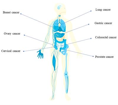 Bacterial infection and microbiota in carcinogenesis and tumor development